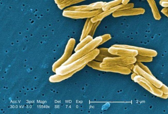 tuberculosis-bacteria-cdc-11090902.jpg