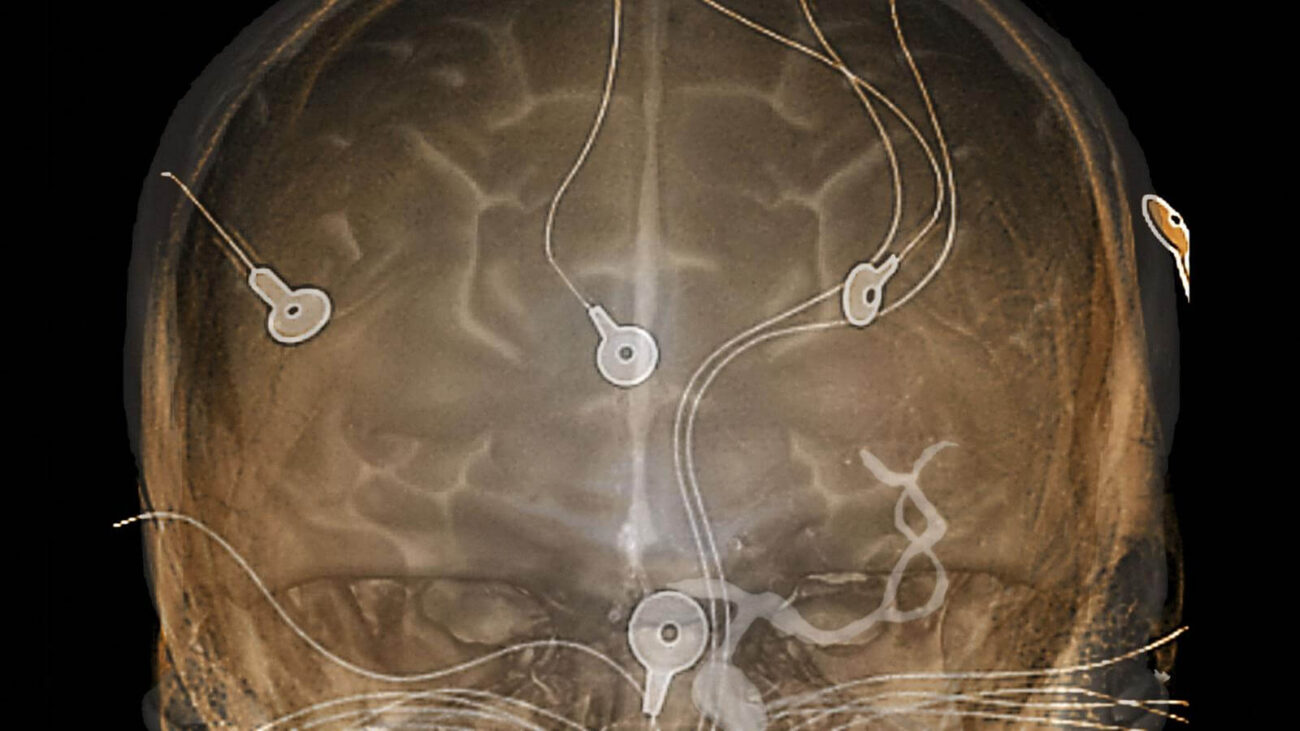 Череп Череп