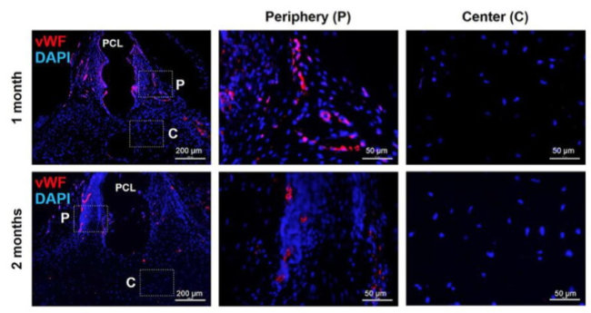 Vascularization Vascularization