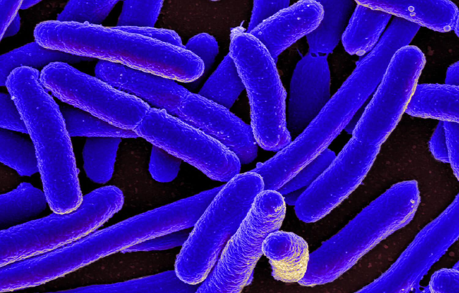 Halanaerobium hydrogeninformans – бактерия, производящая водород