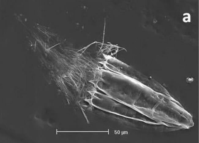 loriciferans loriciferans