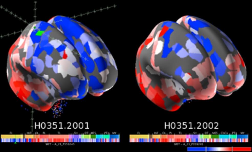 Allen Human Brain Atlas: трехмерная карта головного мозга человека. Allen Human Brain Atlas. Фото.