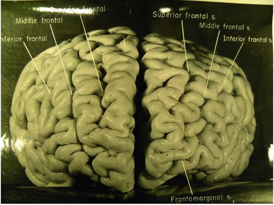 мозг эйншт2