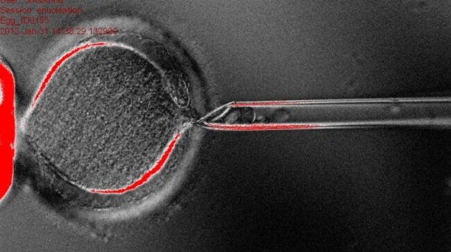 Стволовые клетки впервые получены из клона эмбриона человека. Фото.