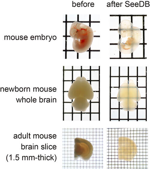 embryo and brain
