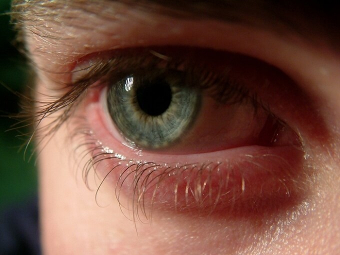 eye