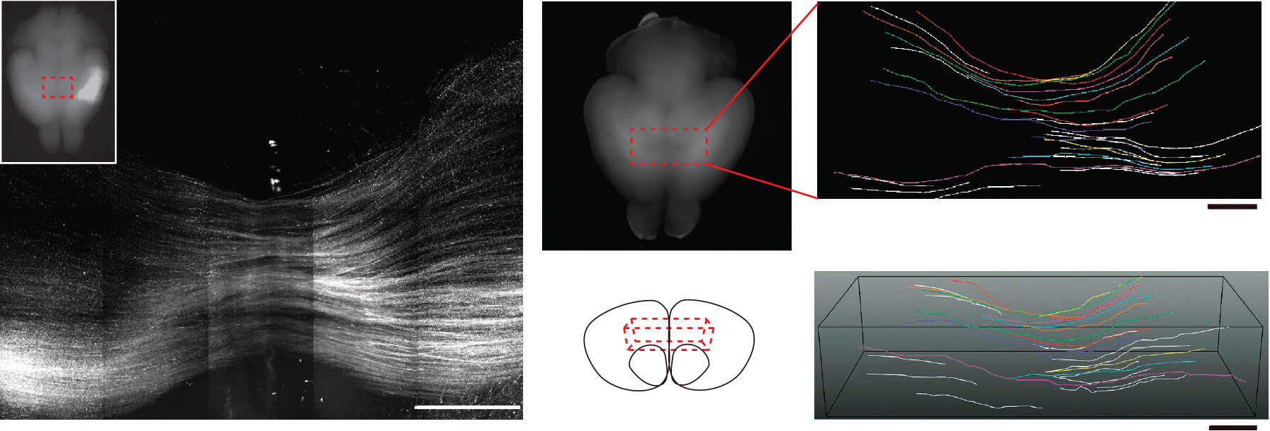 mouse-corpus-callosum
