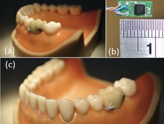 tooth-sensor