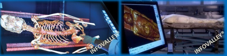 digital-autopsies-11