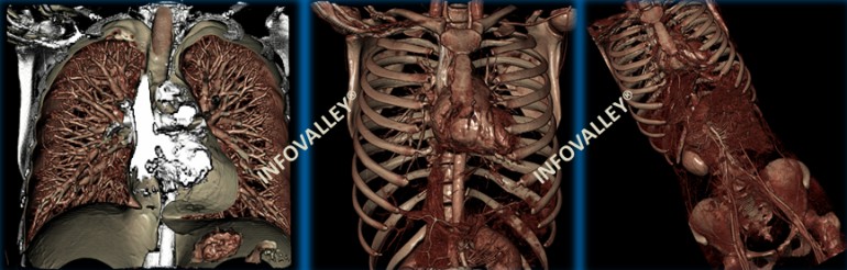 digital-autopsies-12