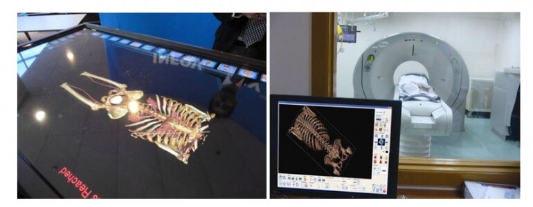 digital-autopsies-13