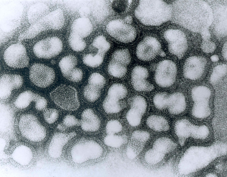 Один из штаммов птичьего гриппа под микроскопом