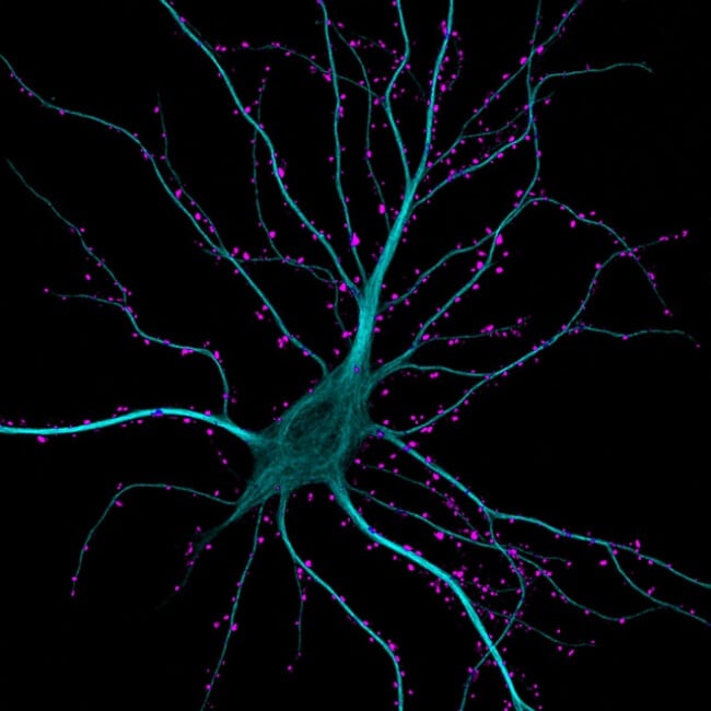 63-кратное увеличение нейрона гиппокампа, части лимбической системы головного мозга.