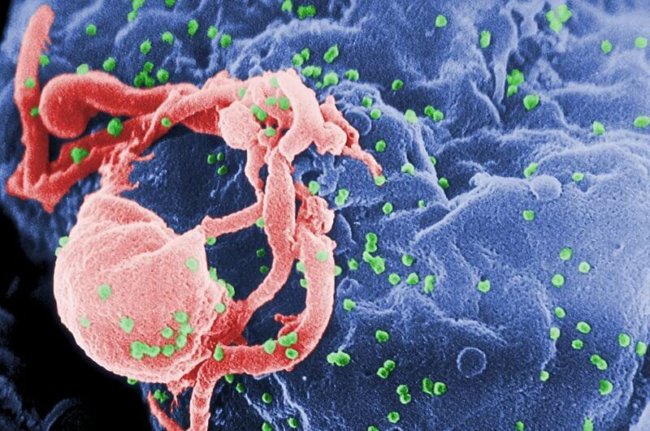 В Африке обнаружена новая и очень опасная форма ВИЧ. Фото.