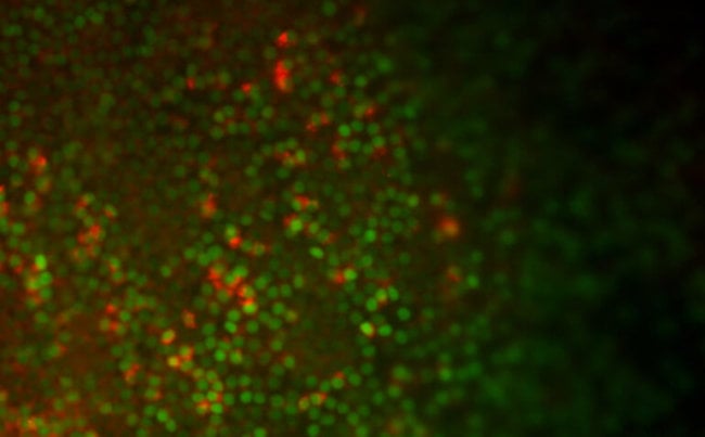 Медицинский прорыв: ученые создали из стволовых клеток функционирующие легочные клетки. Фото.