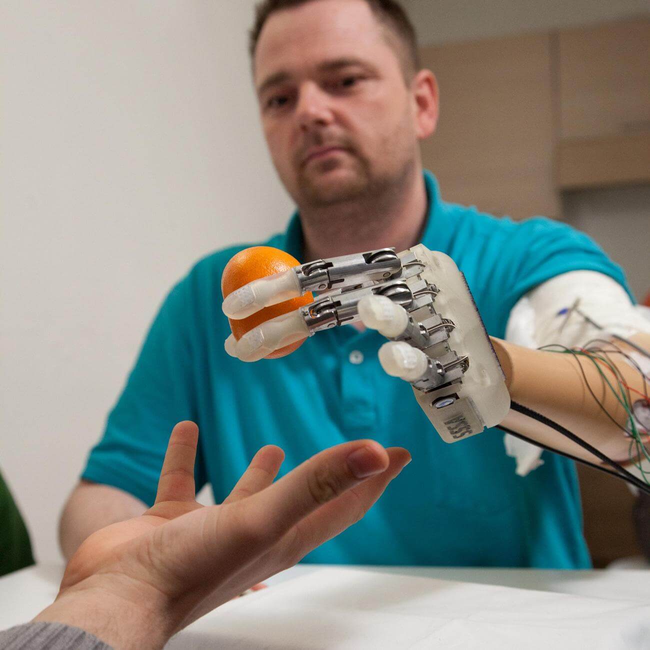 Новый протез подарит осязание Новый протез подарит осязание