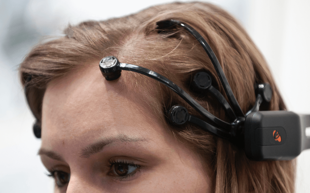 Имплантанты