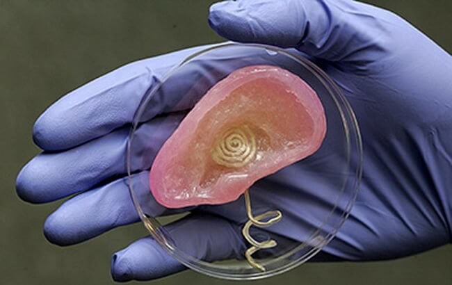 Все, что вам нужно знать о 3D-печати человеческих органов. Фото.