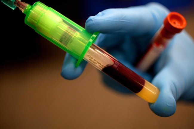 Учёные научились с помощью анализа крови выявлять склонность человека к суициду. Фото.