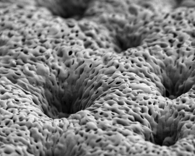 Ученые создали технологию, ускоряющую рост костной ткани. Фото.