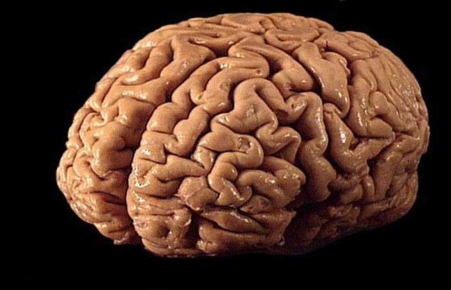 Биологические мозги вряд ли будут последней стадией интеллекта. Фото.