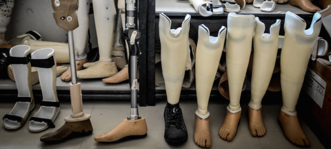Создан протез ноги, который интегрируется прямо в кость. Фото.