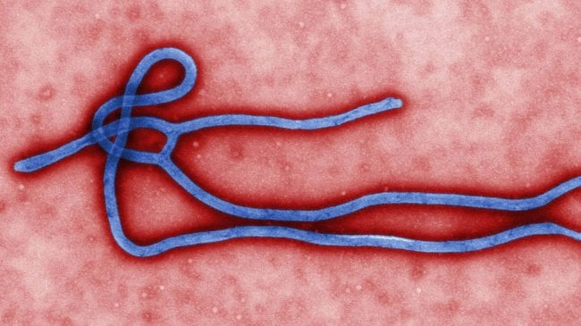 10 причин, по которым Эбола не приведет к концу света. Фото.