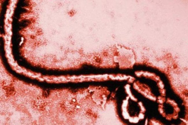 Секреты вируса Эбола. Фото.