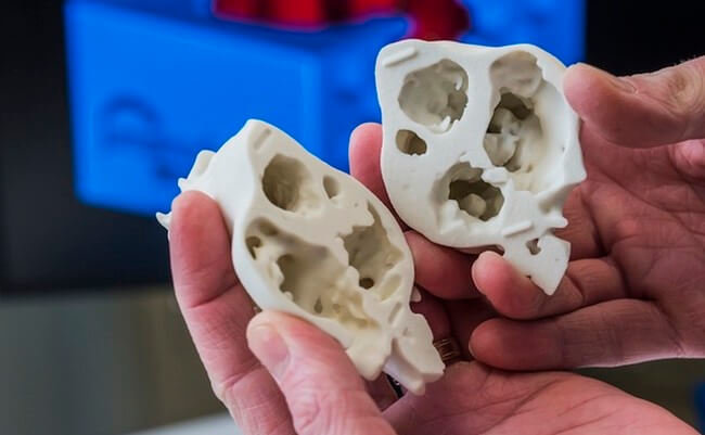 Напечатанные на 3D-принтере сердца помогут спасать детские жизни. Фото.
