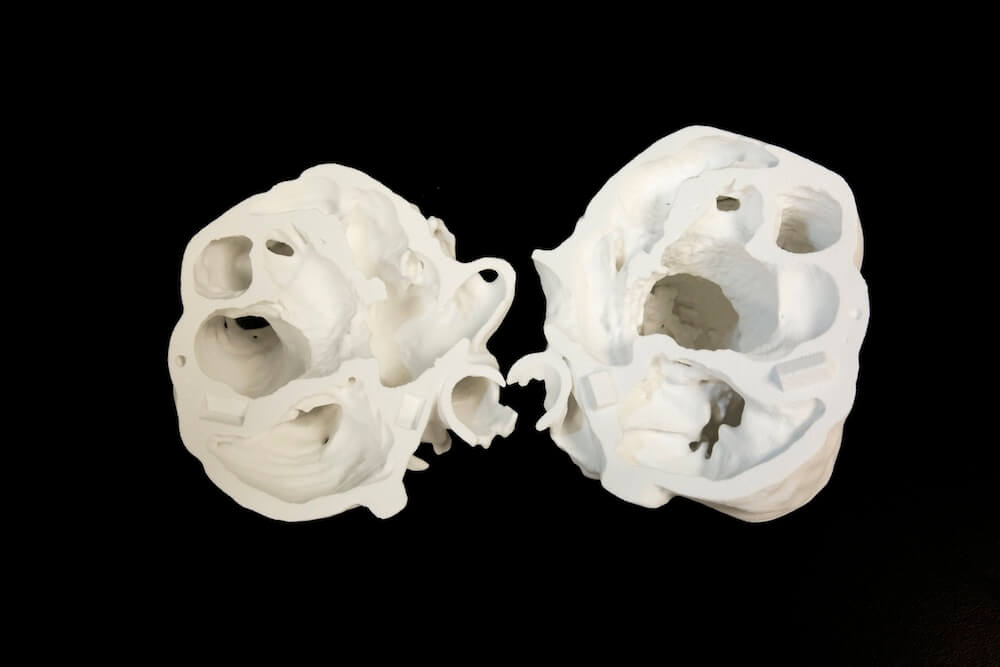 Напечатанные на 3D-принтере сердца помогут спасать детские жизни