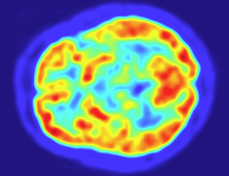 Скан мозга. Фото.