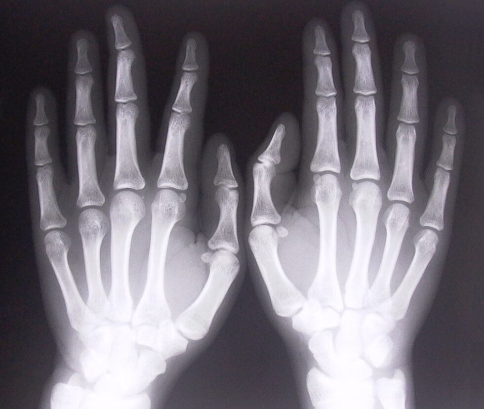 Почему рентгеновские лучи это не свет. Ученый никогда не назовет рентгеновские лучи светом. Фото.