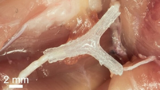 3D-печать поможет нейрохирургам в восстановлении повреждённых нервов. Фото.