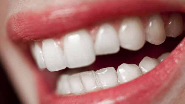 Учёные наделили зубные имплантаты антибактериальными свойствами