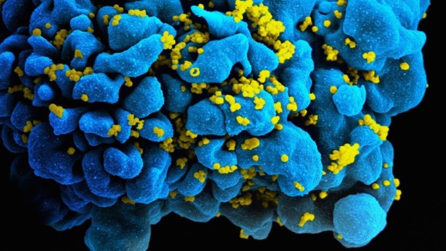 Немецким учёным удалось победить вирус иммунодефицита человека. Фото.