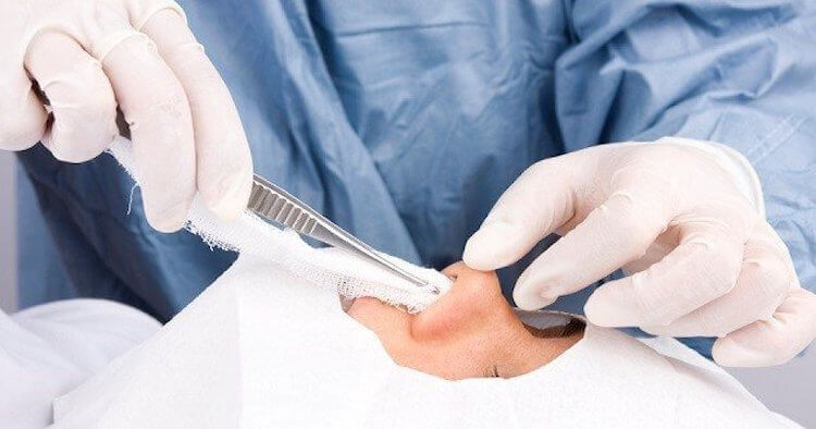 Услугами пластических хирургов пользовались и в древние времена. Фото.