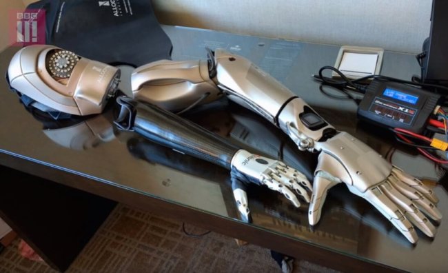 Фанату-инвалиду подарили протез руки из Metal Gear Solid V. Фото.