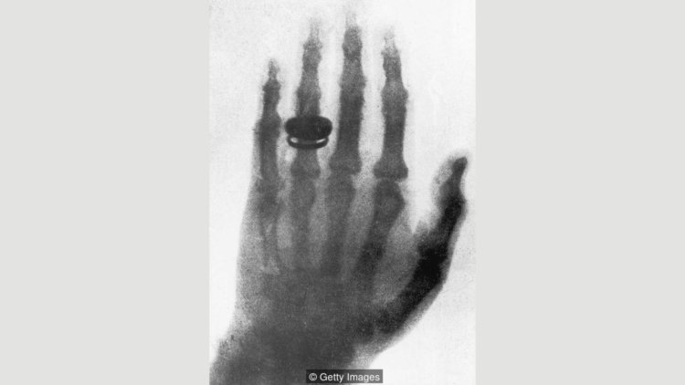 Тайная история рентгеновского зрения. Рентгеновский снимок приоткрыл тайну строения человеческого тела. Фото.