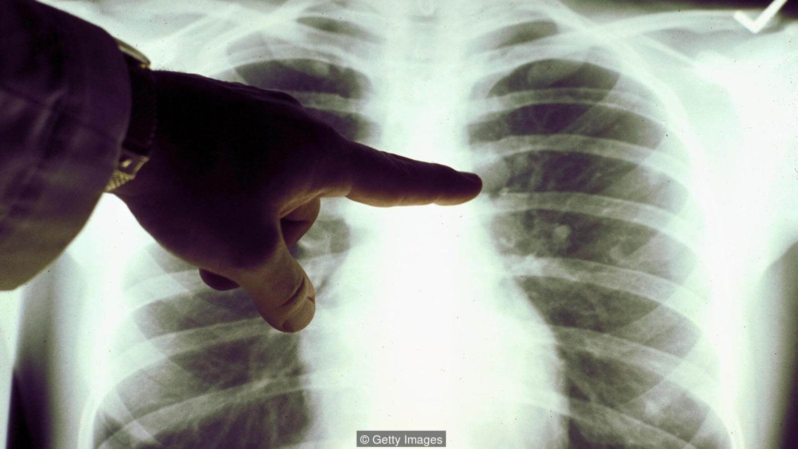 Тайная история рентгеновского зрения. Сейчас невозможно представить себе диагностику некоторых травм и заболеваний без использования рентгена. Фото.