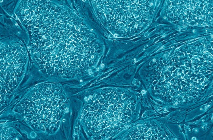 Для чего нужны стволовые клетки. Стволовые клетки могут многое. Фото.