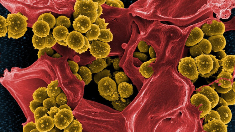 Эра антибиотиков подойдет к своему концу. Устойчивость бактерий к антибиотикам сделает современные противомикробные препараты абсолютно неэффективными уже через 20-30 лет. Фото.