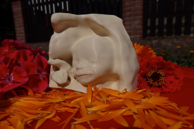 3D-печать позволит слепым матерям впервые «увидеть» своих ещё не родившихся детей