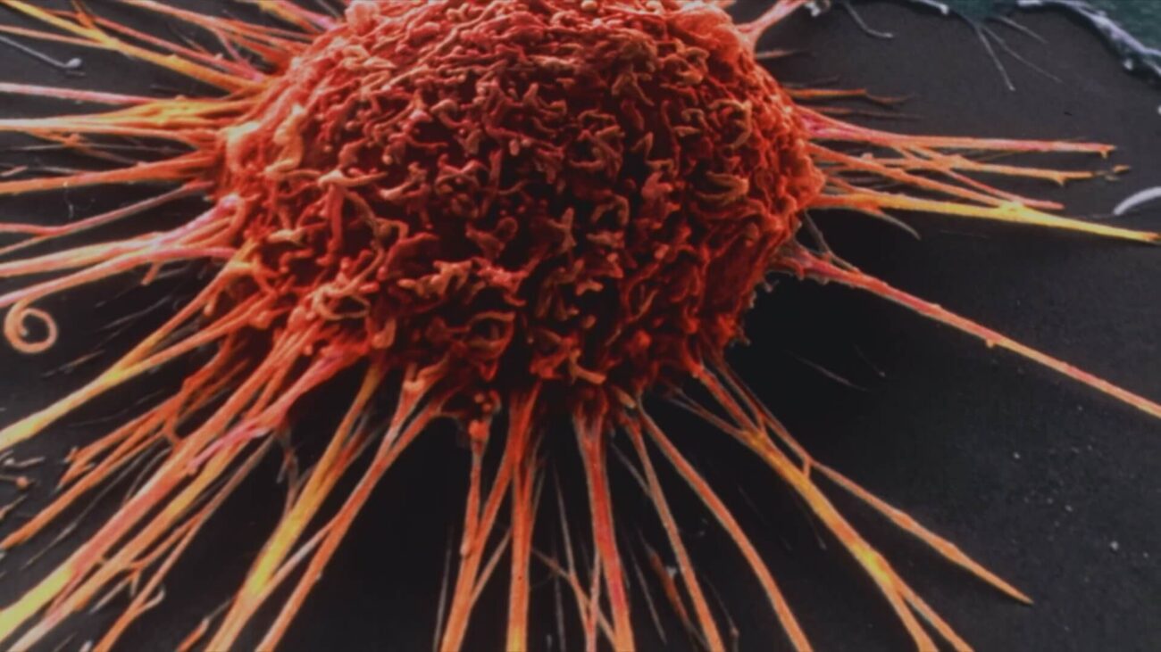 Искусственный интеллект от Microsoft поможет лечить рак. Фото.