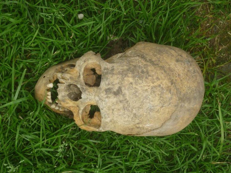 В Кабардино-Балкарии найдено захоронение людей с длинными черепами. Фото.