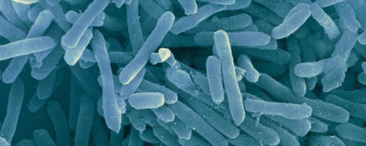 Микроб, которого никто даже не видел, может объяснить наше происхождение. Фото.