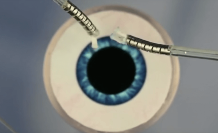 Робот-микрохирург с тентаклями поможет с операциями на глазах. Фото.