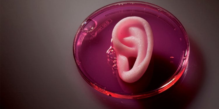Китайские врачи вырастили ухо на руке пациента. Фото.
