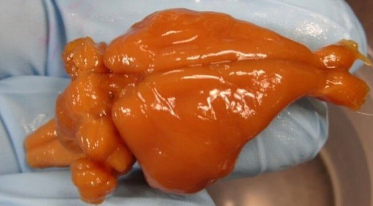 Самые любопытные прогнозы футурологов, которые свершились в 2016 году. Изучение мозга — основа медицины. Фото.