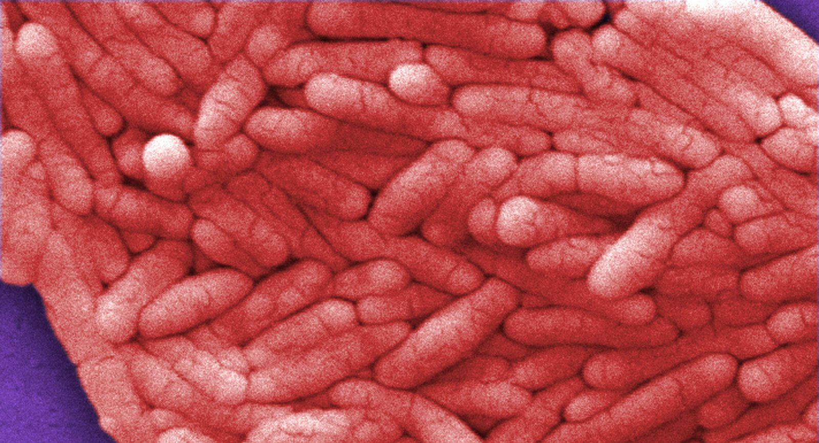 Учёные запрограммировали сальмонеллу на пожирание опухолей мозга.. Фото.