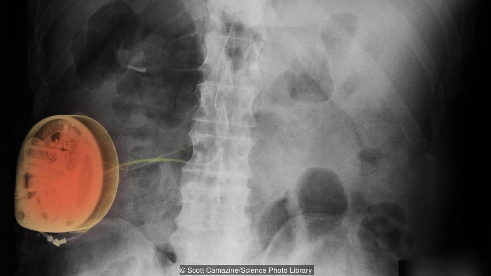 Врачи всегда видят больше, чем мы. Фото.